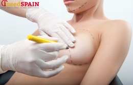 Breast surgery in Barcelona